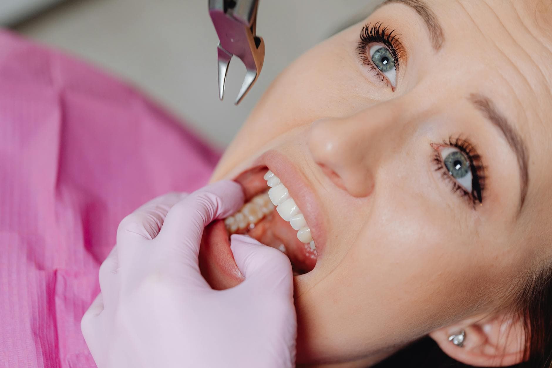 A dentist performing a tooth extraction on a patient in a dental clinic.